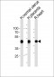 ACTA1/alpha-actin Antibody (C-term)